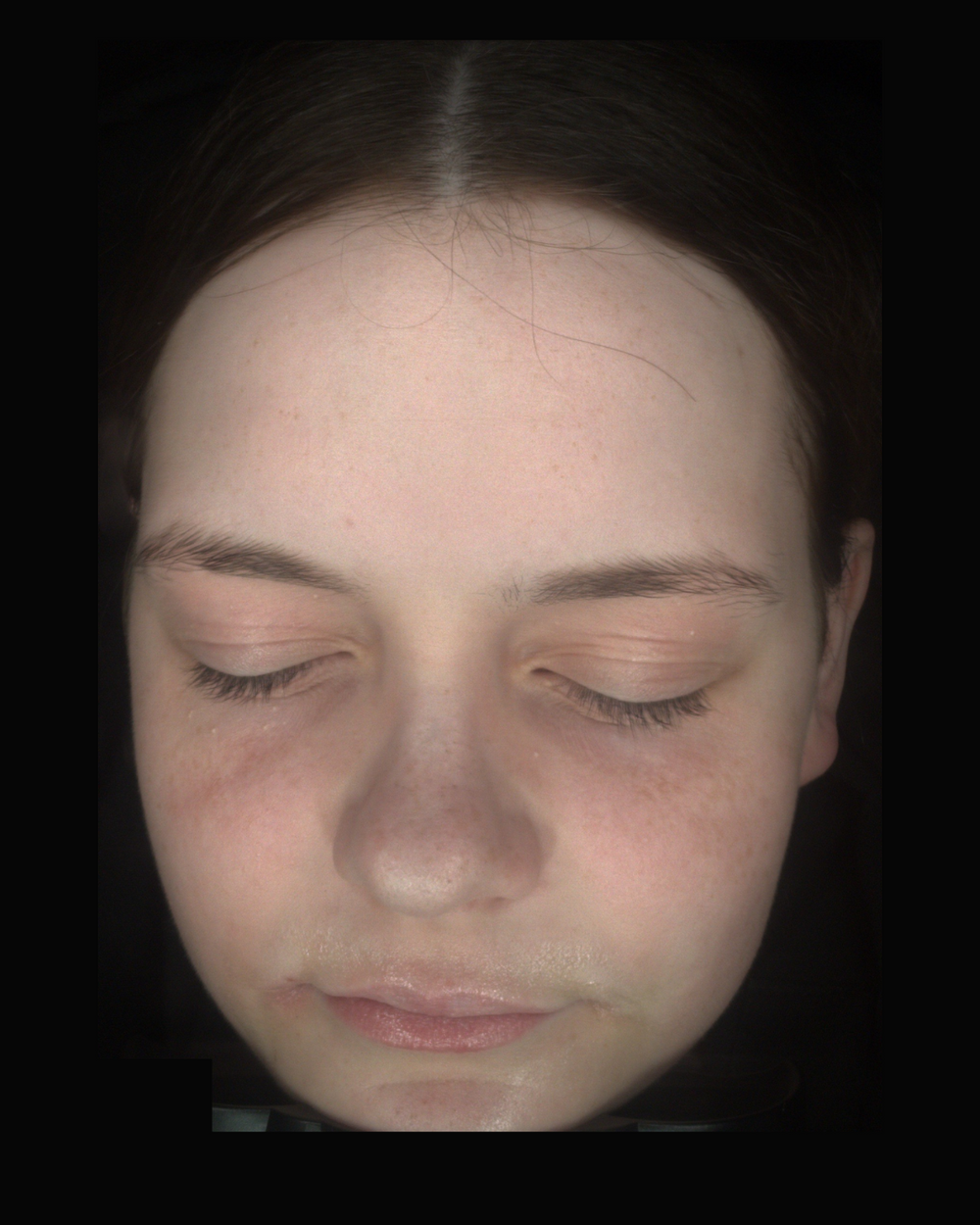 After treatment