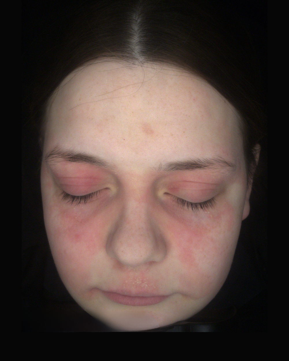 Before treatment