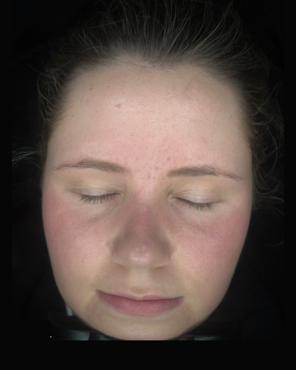 After treatment