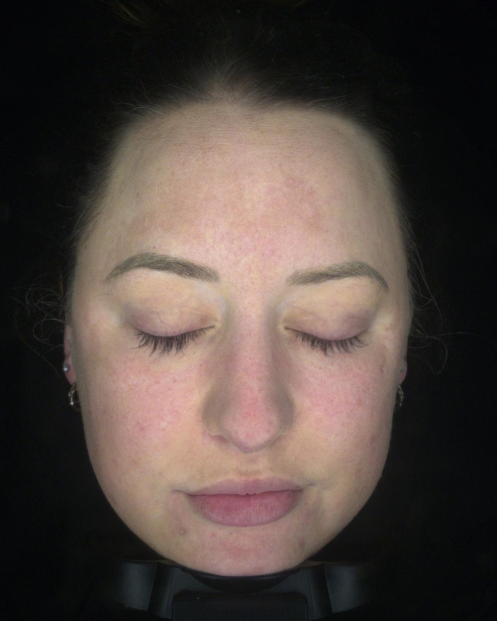 After treatment